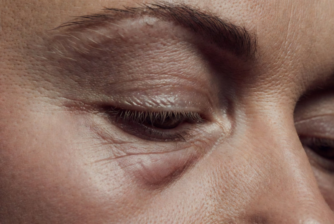 Tired eyes of the woman with puffy bags under eyes